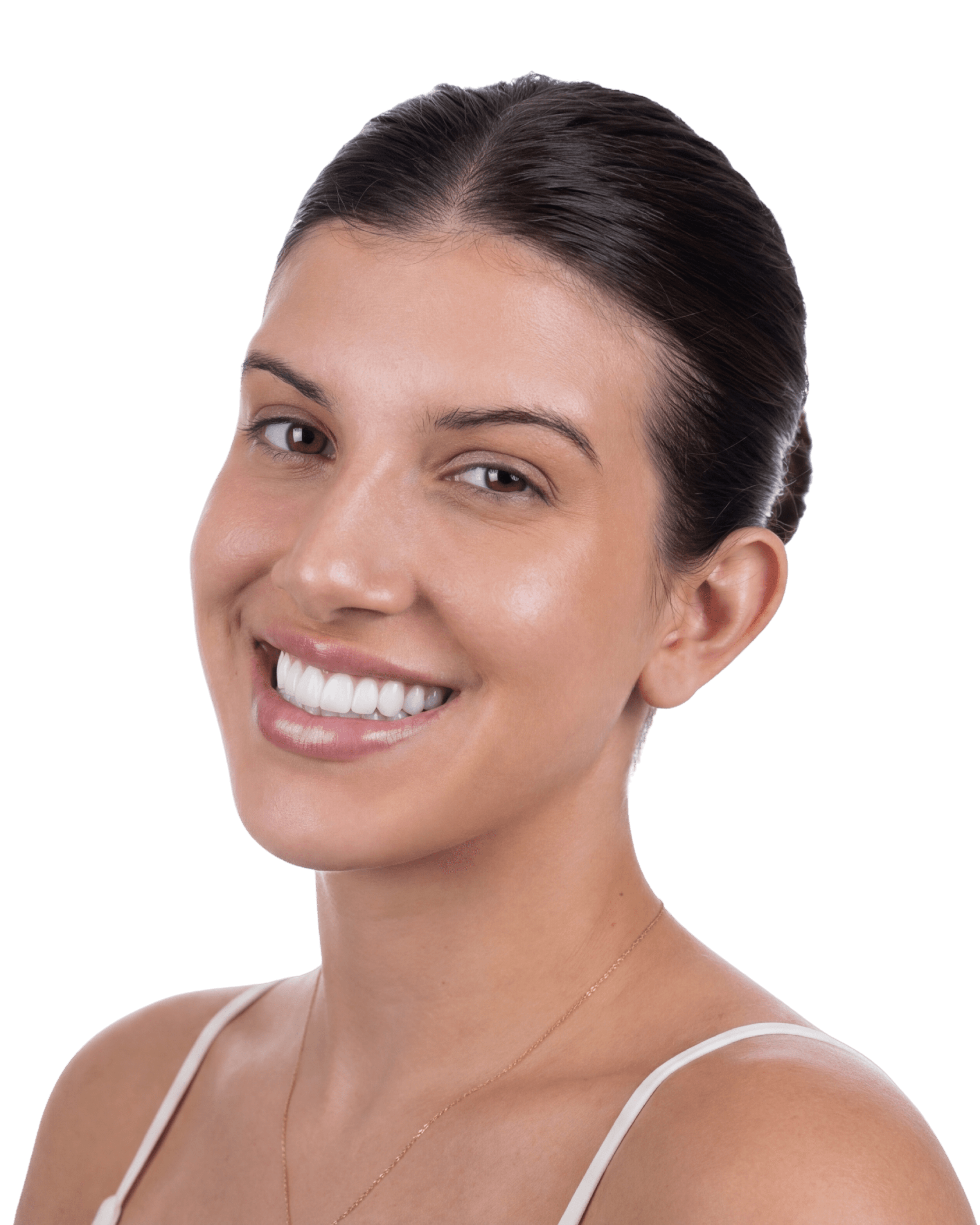 Sorriso premium com estética natural